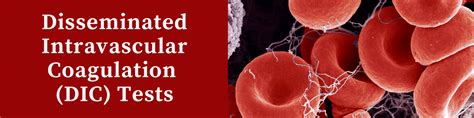 dic lab results|Disseminated Intravascular Coagulopathy (DIC) .